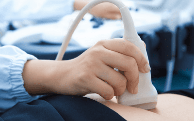 Why You Need an Ultrasound Before Abortion in North Carolina